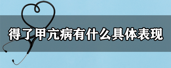 得了甲亢病有什么具体表现