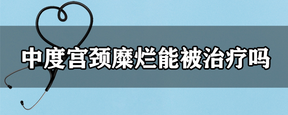 中度宫颈糜烂能被治疗吗